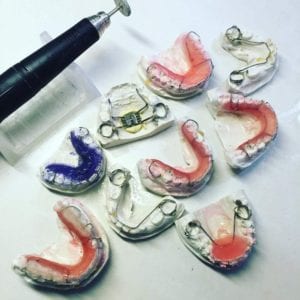 One of the really cool things about Fishbein Orthodontics - We Make our own orthodontic appliances!