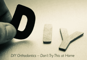 DIY Orthodontics Have Arrived And Are Incredibly Dangerous