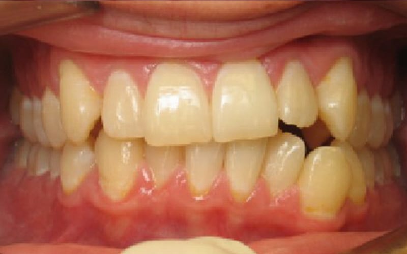 Fishbein Patient Ronald Teeth After Treatment