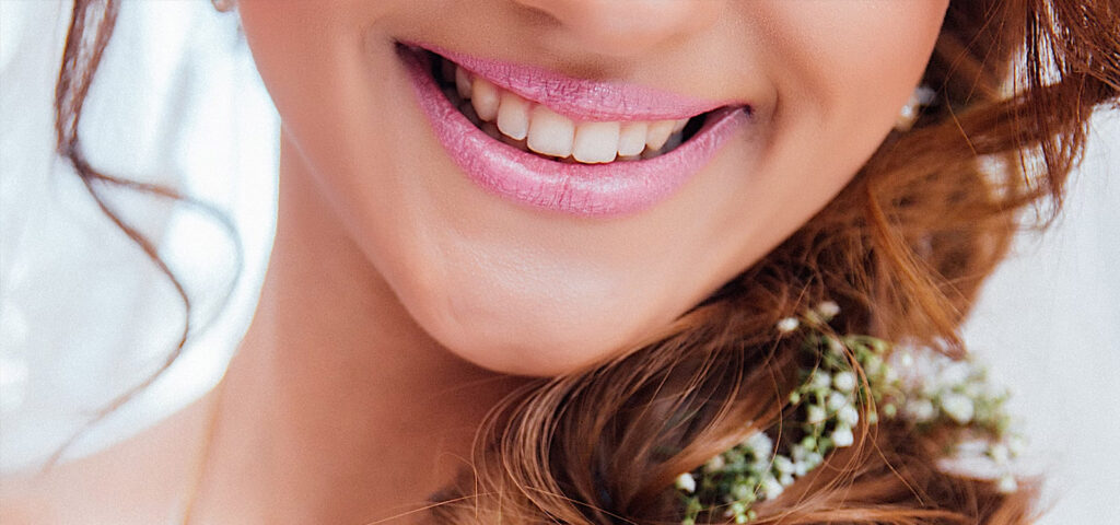 bride smiles after learning the fastest way to straighten teeth before wedding